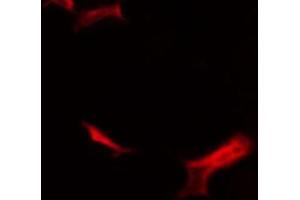 ABIN6268883 staining COLO205 by IF/ICC.