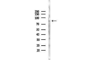 Western blot analysis of lysates from F10-LUC cells(heat-shock 45 min treatment), using SLC9 Antibody at 1/1000 dilution.