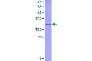 Image no. 1 for Apolipoprotein B mRNA Editing Enzyme, Catalytic Polypeptide-Like 3G (APOBEC3G) (AA 80-181) protein (GST tag) (ABIN1345361)