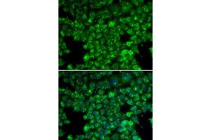 Immunofluorescence analysis of U20S cell using LYZL6 antibody. (LYZL6 anticorps)