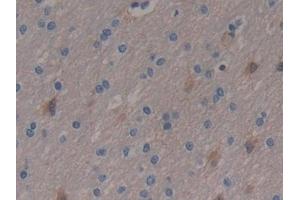 Detection of ENO3 in Human Brain Tissue using Polyclonal Antibody to Enolase 3 (ENO3)
