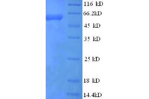 SDS-PAGE (SDS) image for Cystathionine-beta-Synthase (CBS) (AA 2-551) protein (His tag) (ABIN5709209)