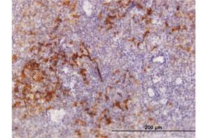 Immunoperoxidase of purified MaxPab antibody to TRAF1 on formalin-fixed paraffin-embedded human tonsil.