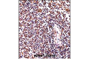HCLS1 Antibody (C-term) ((ABIN657959 and ABIN2846904))immunohistochemistry analysis in formalin fixed and paraffin embedded human spleen tissue followed by peroxidase conjugation of the secondary antibody and DAB staining. (HCLS1 anticorps  (C-Term))