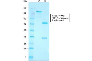 SDS-PAGE Analysis of Purified CD79a Rabbit Recombinant Monoclonal Antibody ABIN6383859. (Recombinant CD79a anticorps  (AA 202-216))
