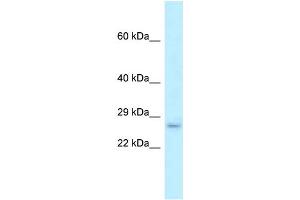 WB Suggested Anti-Fam176b Antibody Titration: 1. (EVA1B anticorps  (Middle Region))