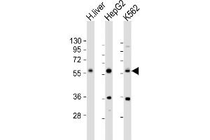 All lanes : Anti-NAGS Antibody (Center) at 1:1000 dilution Lane 1: human liver lysate Lane 2: HepG2 whole cell lysate Lane 3: K562 whole cell lysate Lysates/proteins at 20 μg per lane. (NAGS anticorps  (AA 275-309))