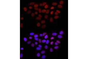Immunofluorescence analysis of HeLa cells using TMPO Rabbit pAb (ABIN3016206, ABIN3016207, ABIN3016208, ABIN1683056 and ABIN1683057) at dilution of 1:50 (40x lens).