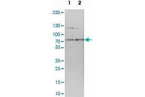 Western blot analysis of cell lysates with RNGTT polyclonal antibody . (RNGTT anticorps)