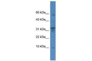 Western Blot showing CTSC antibody used at a concentration of 1-2 ug/ml to detect its target protein.