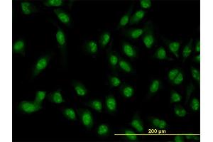 Immunofluorescence of monoclonal antibody to XAB2 on HeLa cell. (XAB2 anticorps  (AA 1-855))