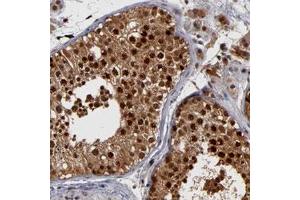 Immunohistochemical staining of human testis with HUWE1 polyclonal antibody  shows strong nuclear and cytoplasmic positivity in cells of seminiferus ducts. (HUWE1 anticorps)