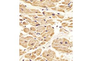 (ABIN388764 and ABIN2839051) staining Nestin in Human heart tissue sections by Immunohistochemistry (IHC-P - paraformaldehyde-fixed, paraffin-embedded sections).