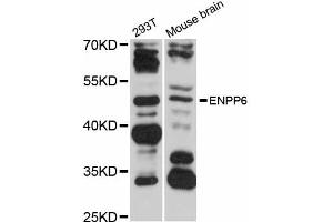 Western blot analysis of extracts of various cell lines, using ENPP6 antibody (ABIN5997678) at 1/1000 dilution. (ENPP6 anticorps)