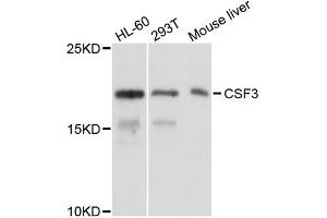 Western blot analysis of extracts of various cell lines, using CSF3 antibody (ABIN5973635) at 1/1000 dilution. (G-CSF anticorps)