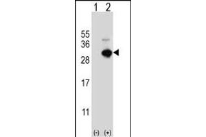 Western blot analysis of GSTO1 (arrow) using rabbit polyclonal GSTO1 Antibody (Center) (ABIN389475 and ABIN2839537). (GSTO1 anticorps  (AA 126-155))