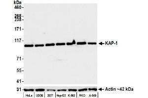 Western Blotting (WB) image for anti-Tripartite Motif Containing 28 (TRIM28) (Ser824) antibody (ABIN7454012) (Recombinant KAP1 anticorps  (Ser824))