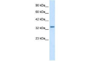 WB Suggested Anti-ZNF134 Antibody Titration:  1. (ZNF134 anticorps  (Middle Region))