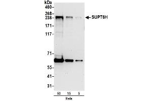 anti-Suppressor of Ty 6 Homolog (SUPT6H) (AA 1050-1100) antibody