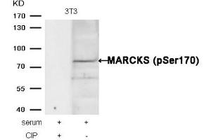 Western blot analysis of extracts from 3T3 cells, treated with serum or calf intestinal phosphatase (CIP), using MARCKS (phospho-Ser170) Antibody.