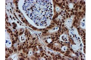 Image no. 3 for anti-Fragile X Mental Retardation 1 (FMR1) antibody (ABIN1498287)