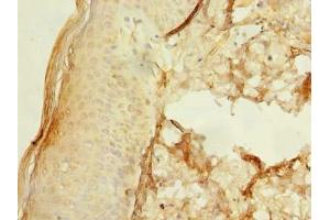 Immunohistochemistry of paraffin-embedded human skin tissue using ABIN7174599 at dilution of 1:100 (UBXN6 anticorps  (AA 1-388))