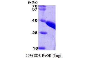 SDS-PAGE (SDS) image for Thiosulfate Sulfurtransferase (Rhodanese) (TST) (AA 1-297) protein (ABIN667753)