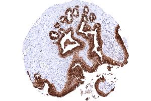 Gallbladder showing a strong predominantly cytoplasmic AGR2 staining of epithelial cells