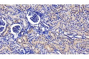 Detection of IL22R in Human Kidney Tissue using Polyclonal Antibody to Interleukin 22 Receptor (IL22R) (IL22 Receptor alpha 1 anticorps  (AA 267-565))