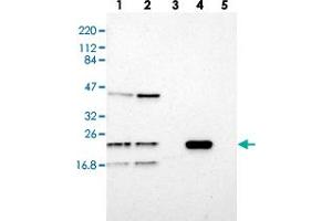 Western blot analysis of Lane 1: RT-4, Lane 2: U-251 MG, Lane 3: Human Plasma, Lane 4: Liver, Lane 5: Tonsil with LDOC1L polyclonal antibody  at 1:250-1:500 dilution. (LDOC1L anticorps)