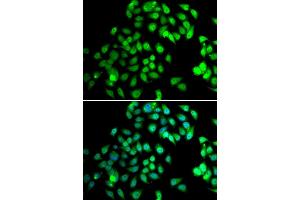 Immunofluorescence analysis of MCF7 cell using NCBP2 antibody. (NCBP2 anticorps)