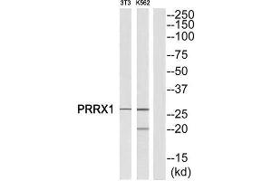 Western Blotting (WB) image for anti-Paired Related Homeobox 1 (PRRX1) (Internal Region) antibody (ABIN1851770) (PRRX1 anticorps  (Internal Region))