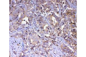 IHC analysis of IQGAP2 using antiIQGAP2 antibody (ABIN5692877). (IQGAP2 anticorps  (AA 1329-1544))