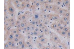 Detection of TOP3 in Human Liver Tissue using Polyclonal Antibody to Topoisomerase III (TOP3) (TOP3A anticorps  (AA 35-179))
