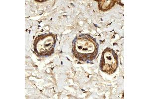 IHC analysis of SPTBN2 using anti-SPTBN2 antibody (ABIN7602111). (Spectrin, Beta, Non-erythrocytic 2 (SPTBN2) (AA 594-1909) anticorps)