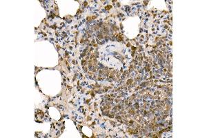 Immunohistochemistry (IHC) image for anti-Nuclear Factor of kappa Light Polypeptide Gene Enhancer in B-Cells 1 (NFKB1) (AA 740-964) antibody (ABIN6144571)