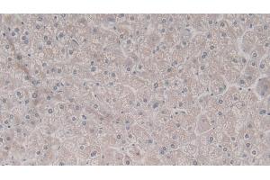 anti-TNFRSF1A-Associated Via Death Domain (TRADD) (AA 61-297) antibody