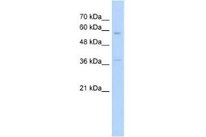 WB Suggested Anti-ITGBL1 Antibody Titration:  5. (ITGBL1 anticorps  (N-Term))