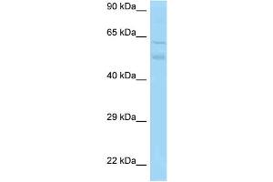 WB Suggested Anti-Pacsin3 Antibody Titration: 1. (PACSIN3 anticorps  (C-Term))
