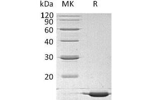 Western Blotting (WB) image for Interleukin 1 alpha (IL1A) protein (ABIN7320583) (IL1A Protéine)