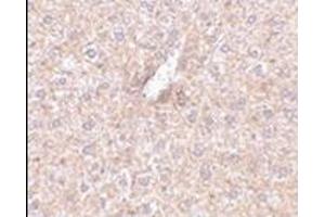 Immunohistochemistry of STEAP3 in mouse liver tissue with this product at 2. (STEAP3 anticorps  (N-Term))