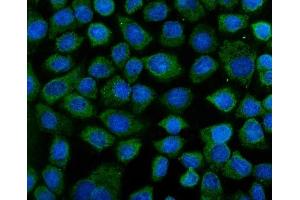 IF analysis of KEAP1 using anti-KEAP1 antibody (ABIN7602552). (KEAP1 anticorps  (AA 84-312))