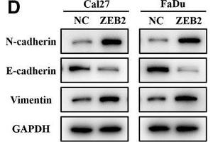 Reintroduction of exogenous ZEB2 largely attenuated the phenotypical changes induced by ZEB2-AS1 inhibition. (Vimentin anticorps)