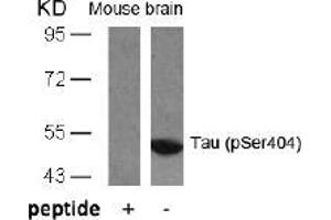 Image no. 1 for anti-Microtubule-Associated Protein tau (MAPT) (pSer404) antibody (ABIN196810) (MAPT anticorps  (pSer404))