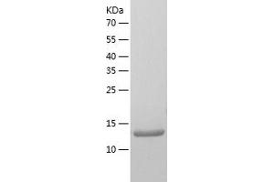Western Blotting (WB) image for KH Homology Domain Containing 1-Like (KHDC1L) (AA 1-128) protein (His tag) (ABIN7123681)