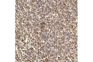 IHC analysis of RAB7/RAB7A using anti-RAB7/RAB7A antibody (ABIN7600597). (RAB7A anticorps  (AA 21-177))