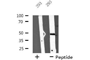 Western blot analysis of extracts from 293 cells, using ZAR1 antibody. (Zygote Arrest 1 anticorps  (Internal Region))