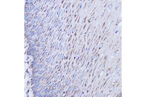 Immunohistochemistry of paraffin-embedded human esophageal using MT-ND1 antibody (ABIN7268598) at dilution of 1:100 (40x lens).