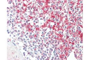Anti-ADAM19 antibody IHC staining of human spleen. (ADAM19 anticorps  (AA 574-588))