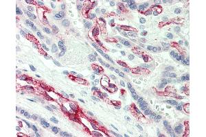 Anti-CASP2 / Caspase 2 antibody IHC of human placenta. (Caspase 2 anticorps  (N-Term))